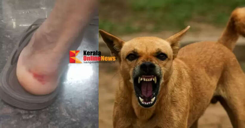 Middle-aged man bitten in stray dog ​​attack in Taliparamba Poomangalam