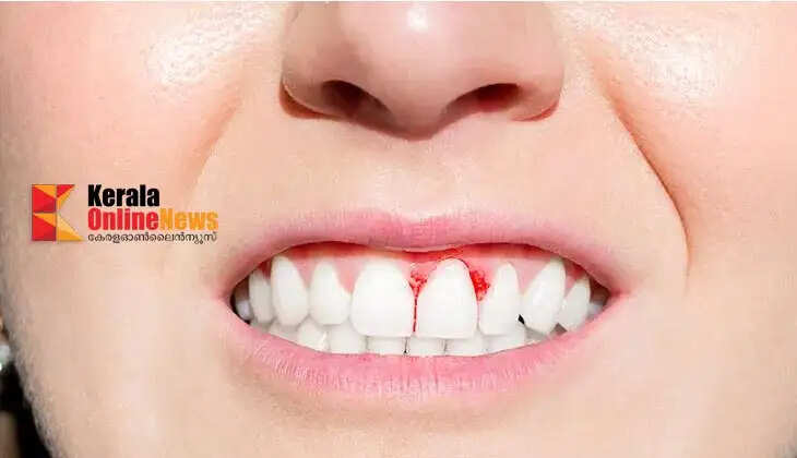 teeth blood