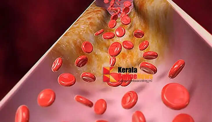 badcholesterol