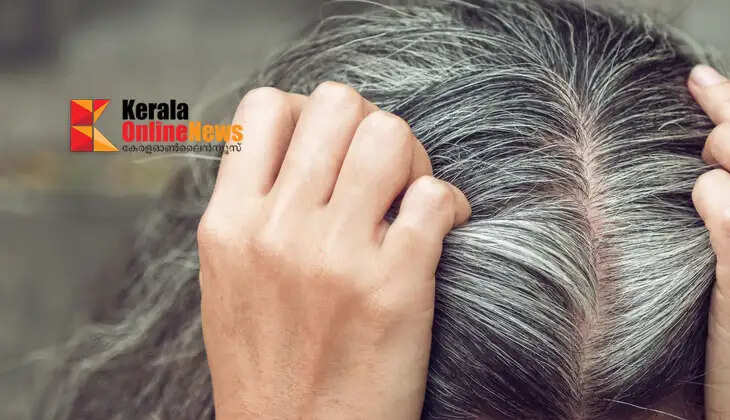 Are you turning gray at an early age?