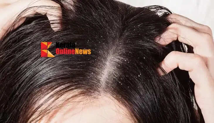 dry scalp