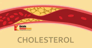 cholesterol