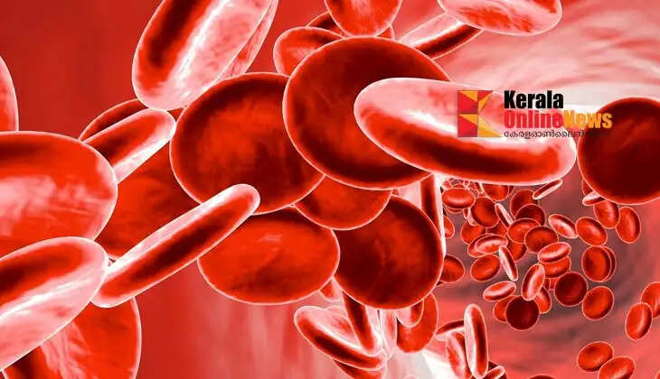 anemia