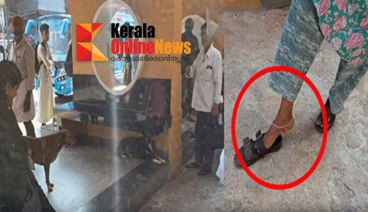 Stray dog ​​attack again in Kannur; A female passenger was attacked by a stray dog ​​in Thaliparambi