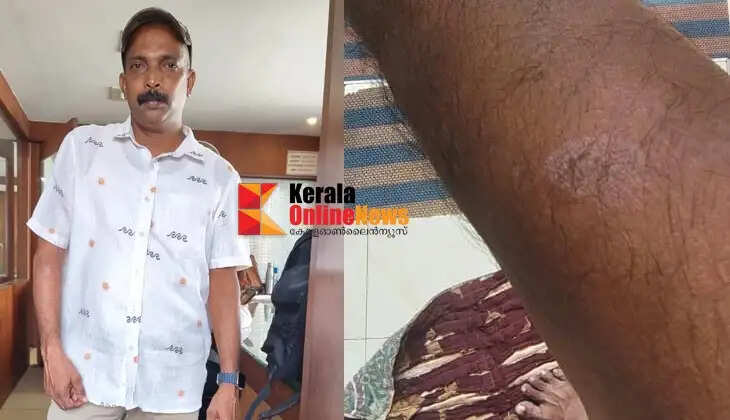 Channel cameraman suffers sunstroke in Kannur; Seal TV cameraman Shaji Keezhara seeks treatment