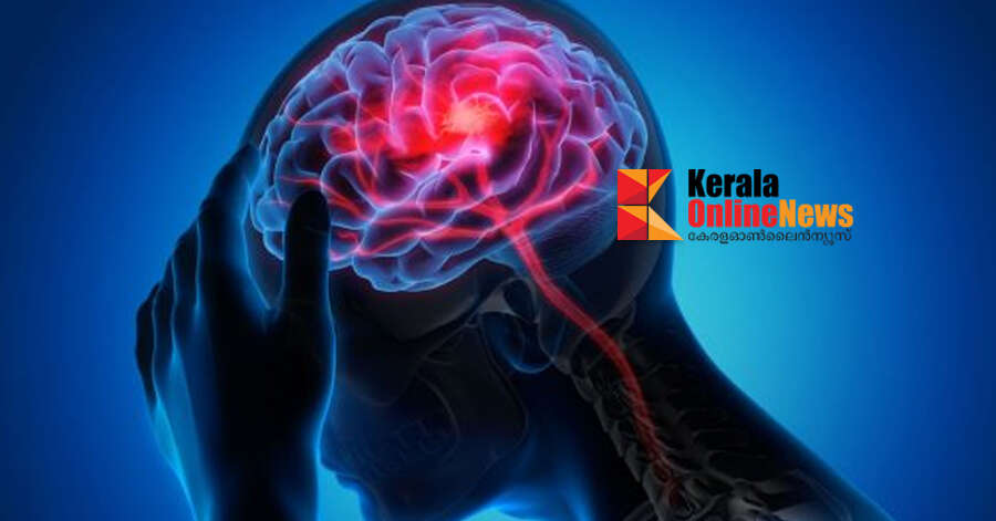 കണ്ണമംഗലത്ത് ജപ്പാന്‍ മസ്തിഷ്കജ്വരം സ്ഥിരീകരണം