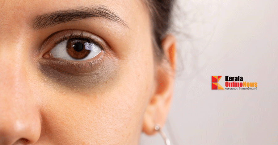 കണ്ണിന് കീഴെയുള്ള പാടുകൾ മാറാൻ ഇത് ഉപയോഗിക്കൂ ..